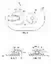Fig. 07 - Incisional absorbent dressing