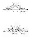 Fig. 08 - Incisional absorbent dressing