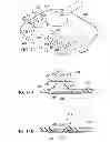 Fig. 09 - Incisional absorbent dressing