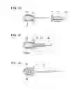 Fig. 07 - Medical device