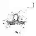 Fig. 08 - Absorbent article comprising fluid handling zones
