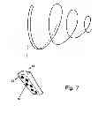 Fig. 06 - System, device and method for ablation of a vessel's wall from the inside