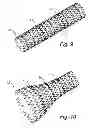 Fig. 08 - System, device and method for ablation of a vessel's wall from the inside