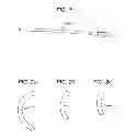 Fig. 02 - RIGID REINFORCING EXOSKELETAL SLEEVE FOR DELIVERY OF FLOWABLE BIOCOMPATIBLE MATERIALS