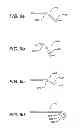 Fig. 07 - RIGID REINFORCING EXOSKELETAL SLEEVE FOR DELIVERY OF FLOWABLE BIOCOMPATIBLE MATERIALS