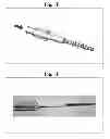 Fig. 12 - Bone screws and methods of use thereof