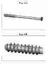Fig. 22 - Bone screws and methods of use thereof