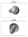 Fig. 34 - Bone screws and methods of use thereof