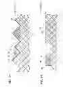 Fig. 06 - Catheter