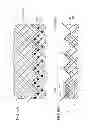 Fig. 07 - Catheter