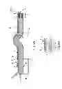 Fig. 07 - Catheter with retractable cover and pressurized fluid