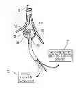 Fig. 01 - GUIDED CARDIAC ABLATION CATHETERS