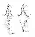 Fig. 03 - GUIDED CARDIAC ABLATION CATHETERS
