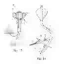 Fig. 11 - GUIDED CARDIAC ABLATION CATHETERS