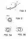 Fig. 02 - Device, apparatus, and method of adipose tissue treatment