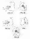 Fig. 07 - DEVICE AND METHOD FOR ABLATING TISSUE