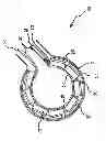 Fig. 01 - Apparatus and method for cooling and moving ablation elements