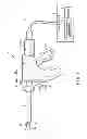Fig. 02 - Grasping treatment device