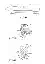 Fig. 10 - Grasping treatment device