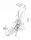 Fig. 02 - Needle probe guide