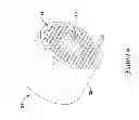 Fig. 07 - METHODS AND DEVICES FOR REDUCING BUBBLE FORMATIONS IN FLUID DELIVERY DEVICES