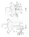 Fig. 02 - Method and devices for performing biatrial coagulation