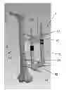 Fig. 01 - Method for treating a fracture of a bone having a medullary canal