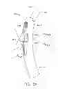 Fig. 43 - BONE FIXATION DEVICE, TOOLS AND METHODS