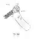 Fig. 49 - BONE FIXATION DEVICE, TOOLS AND METHODS