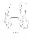 Fig. 09 - SYSTEM AND METHOD FOR ANTERIOR APPROACH FOR INSTALLING TIBIAL STEM