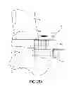 Fig. 20 - SYSTEM AND METHOD FOR ANTERIOR APPROACH FOR INSTALLING TIBIAL STEM