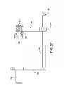 Fig. 45 - SYSTEM AND METHOD FOR ANTERIOR APPROACH FOR INSTALLING TIBIAL STEM