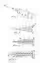 Fig. 04 - INTEROCULAR INJECTOR