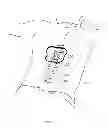 Fig. 02 - Implantable lead
