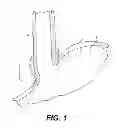 Fig. 02 - TISSUE FASTENERS AND RELATED DEPLOYMENT SYSTEMS AND METHODS