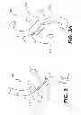 Fig. 04 - TISSUE FASTENERS AND RELATED DEPLOYMENT SYSTEMS AND METHODS