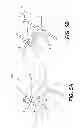 Fig. 06 - TISSUE FASTENERS AND RELATED DEPLOYMENT SYSTEMS AND METHODS