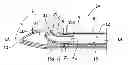 Fig. 01 - Material removal device and method of use