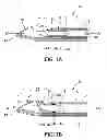 Fig. 02 - Material removal device and method of use