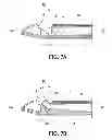 Fig. 07 - Material removal device and method of use