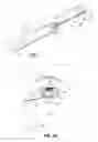 Fig. 02 - Method and device for treating an ocular disorder