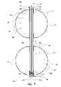 Fig. 03 - Inflation devices for intragastric devices with improved attachment and detachment and associated systems and methods
