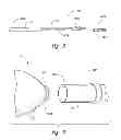 Fig. 05 - Inflation devices for intragastric devices with improved attachment and detachment and associated systems and methods