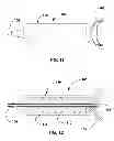 Fig. 07 - Devices and methods for Dilating a Eustachian Tube