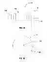 Fig. 09 - Devices and methods for Dilating a Eustachian Tube