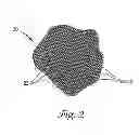 Fig. 04 - Embolic filters with controlled pore size