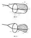Fig. 09 - Complex wire formed devices