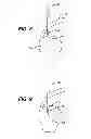 Fig. 06 - PARTIAL THICKNESS ROTATOR CUFF REPAIR SYSTEM AND METHOD