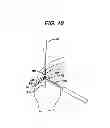 Fig. 07 - PARTIAL THICKNESS ROTATOR CUFF REPAIR SYSTEM AND METHOD