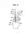 Fig. 09 - PARTIAL THICKNESS ROTATOR CUFF REPAIR SYSTEM AND METHOD